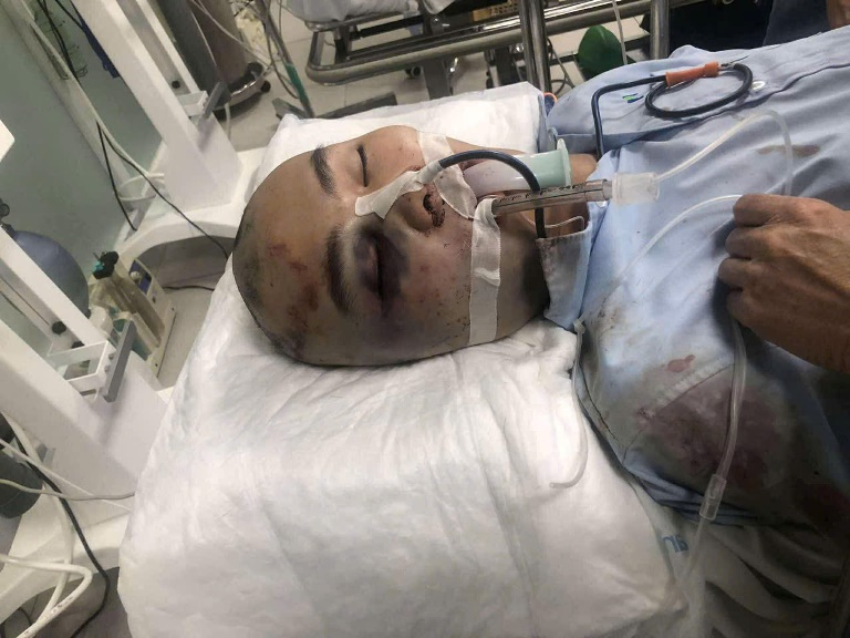 Xót xa hoàn cảnh đáng thương của cháu Ngô Văn&nbsp;Vinh